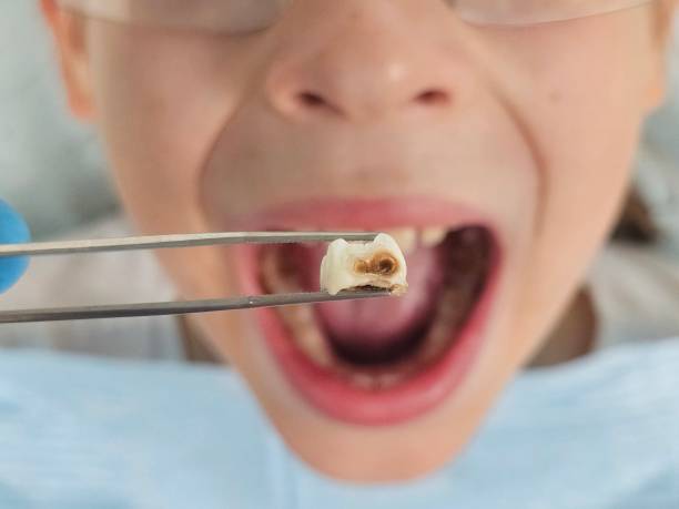 Best Emergency Orthodontic Repairs in Forest Meadows, CA