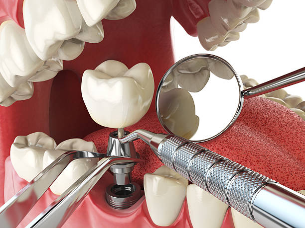 Best 24-Hour Emergency Dental Care in Forest Meadows, CA